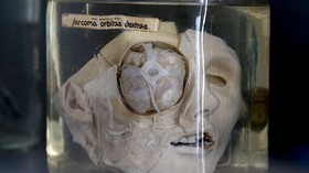 FOTO: Pameran Potongan dan Organ Tubuh Manusia di Wina