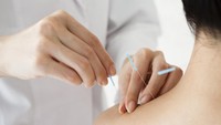 Akupunktur untuk Atasi Hipermesis Gravidarum, Efektifkah Kurangi Mual & Muntah?