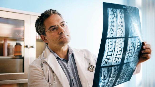 Dokter memberikan penjelasan lengkap mengenai spinal cord injury atau cedera tulang belakang, penyebab, penanganan, hingga bahayanya.