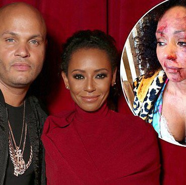Pernah Babak Belur Jadi Korban KDRT, Mel B Dapat Penghargaan MBE Inggris