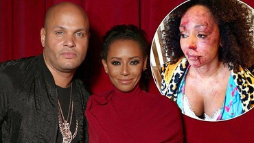 Pernah Babak Belur Jadi Korban KDRT, Mel B Dapat Penghargaan MBE Inggris