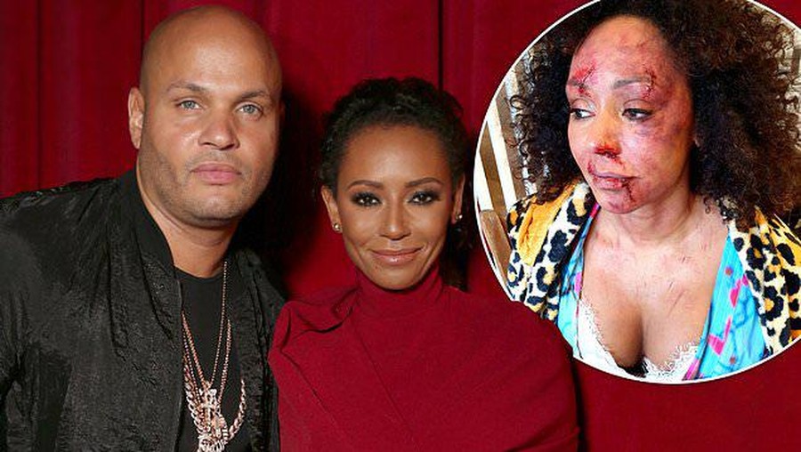 Mel B Mel B