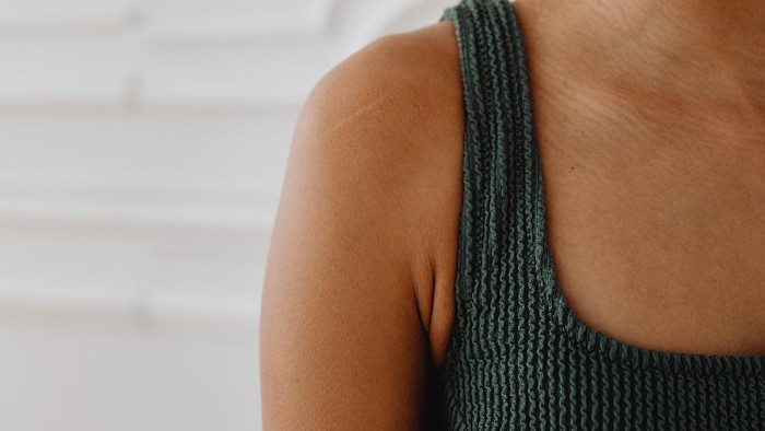 Mirip Jerawat, Ketahui 4 Tanda Hidradenitis Suppurativa, Peradangan Kelenjar Keringat di Ketiak