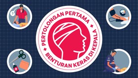 INFOGRAFIS: Pertolongan Pertama saat Benturan Keras di Kepala
