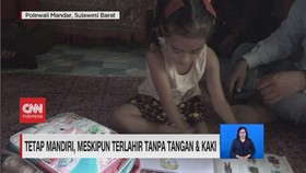VIDEO: Perjuangan Hidup Gadis Cilik Tanpa Tangan Dan Kaki