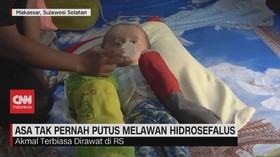 VIDEO: Asa Tak Pernah Putus, Melawan Hidrosefalus