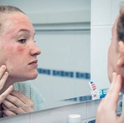 BeauPicks: Rekomendasi Toner Non Alkohol yang Aman untuk Semua Jenis Kulit