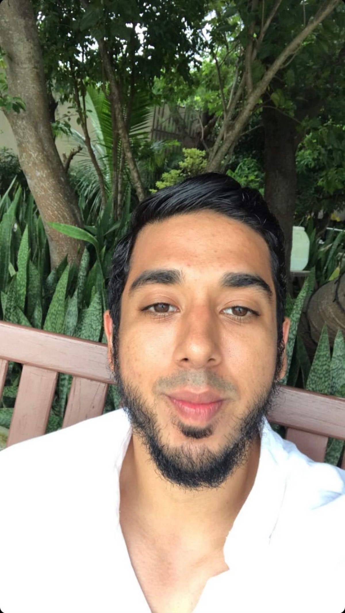 Belum lama ini putra Ayu Azhari&comma; Axel Gondokusumo mengaku menjadi korban pemukulan di salah satu klub di Bali&period; Yuk intip potretnya&excl;