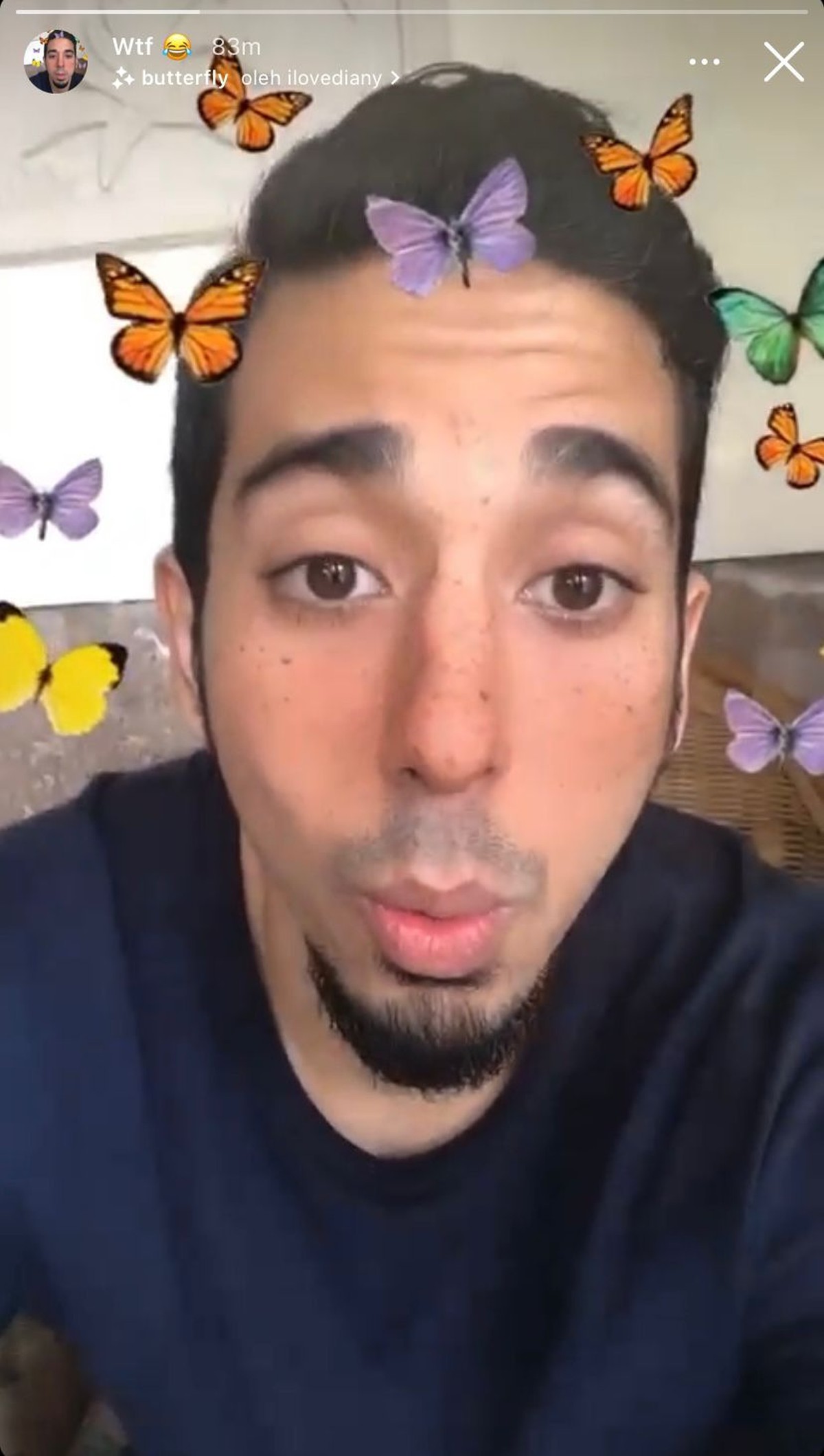 Belum lama ini putra Ayu Azhari&comma; Axel Gondokusumo mengaku menjadi korban pemukulan di salah satu klub di Bali&period; Yuk intip potretnya&excl;