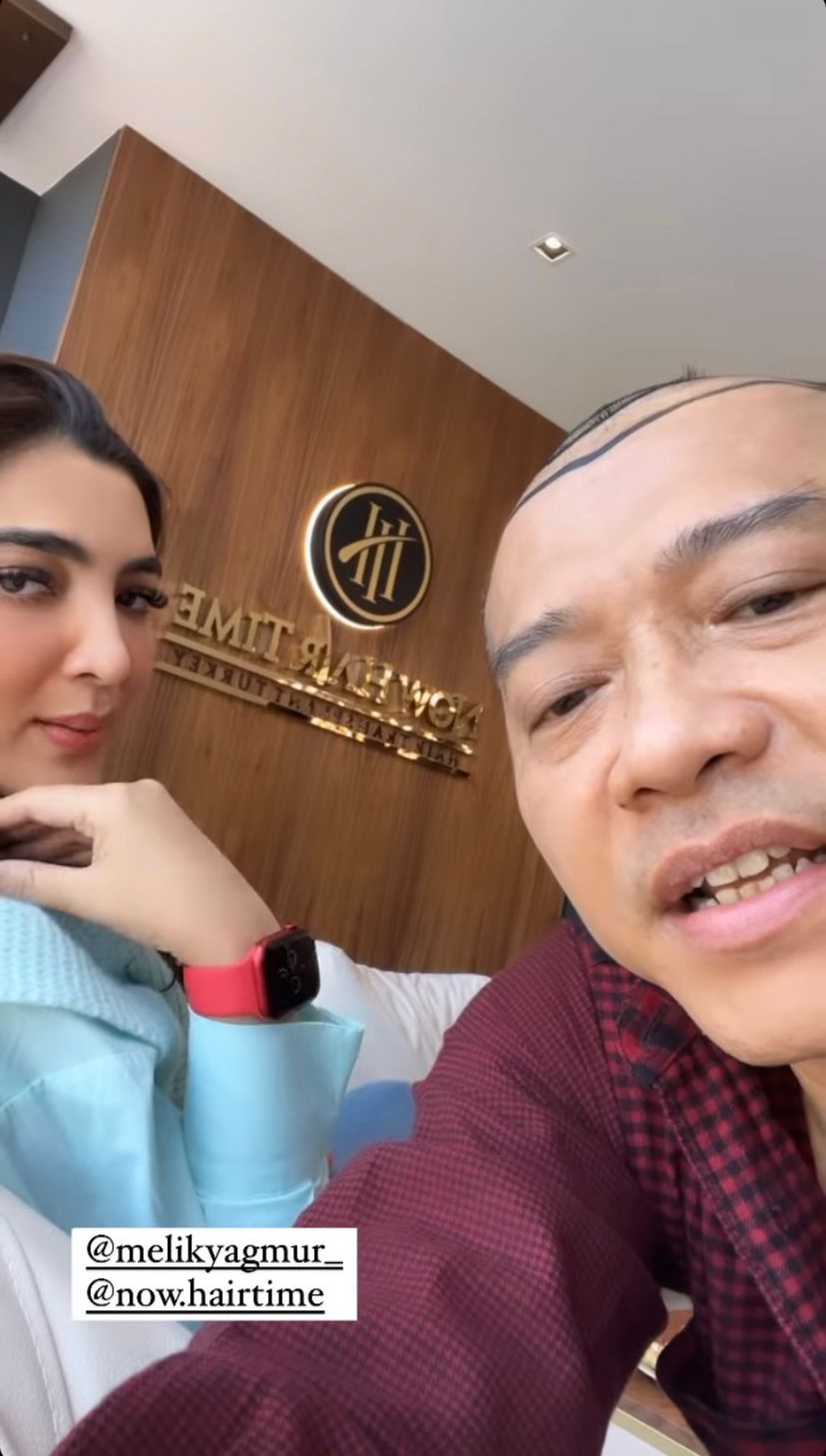 Anang Hermansyah memamerkan rambut barunya yang sangat beda saat liburan di Turkey&period; Yuk intip potretnya&excl;