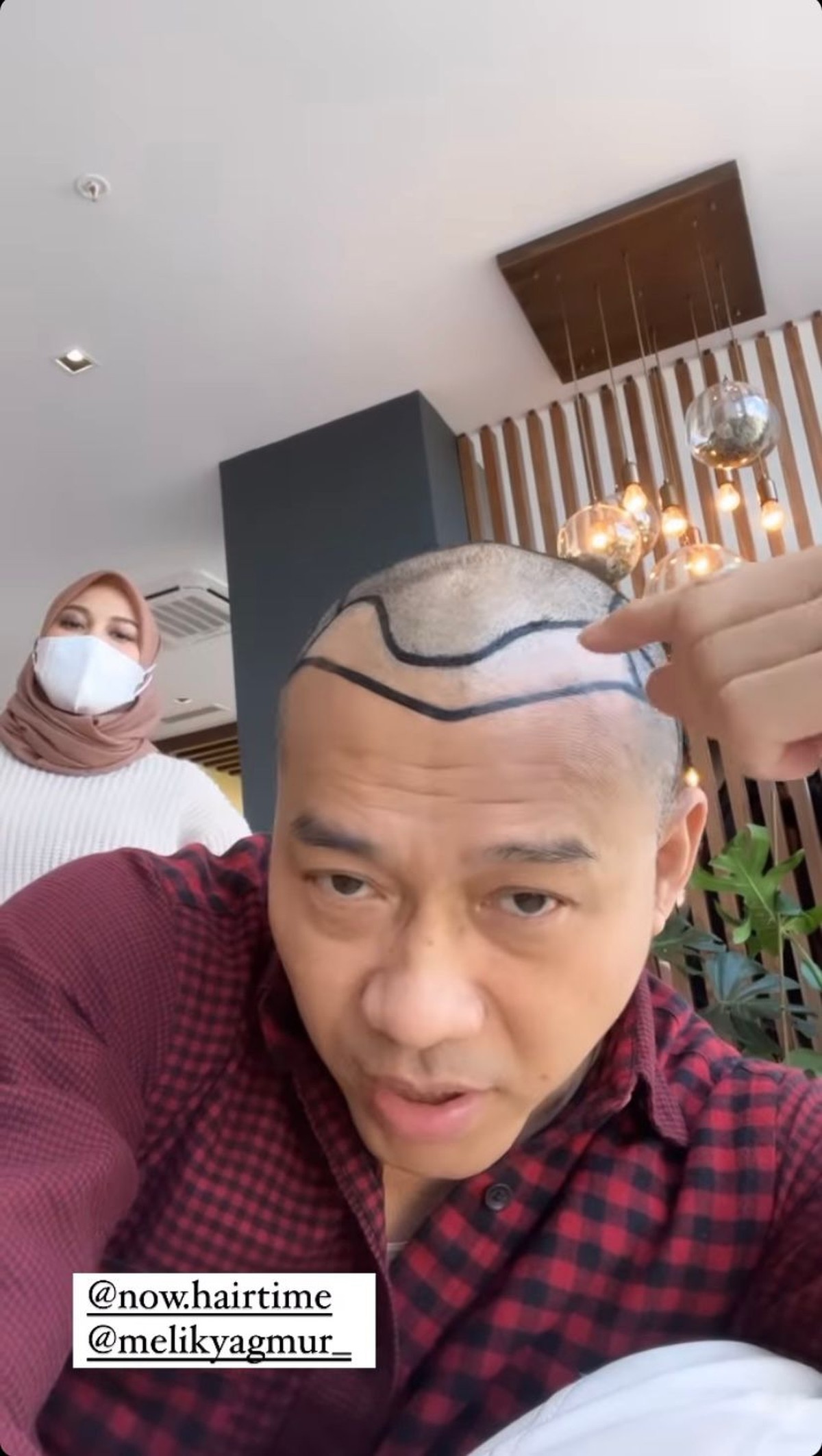Anang Hermansyah memamerkan rambut barunya yang sangat beda saat liburan di Turkey&period; Yuk intip potretnya&excl;