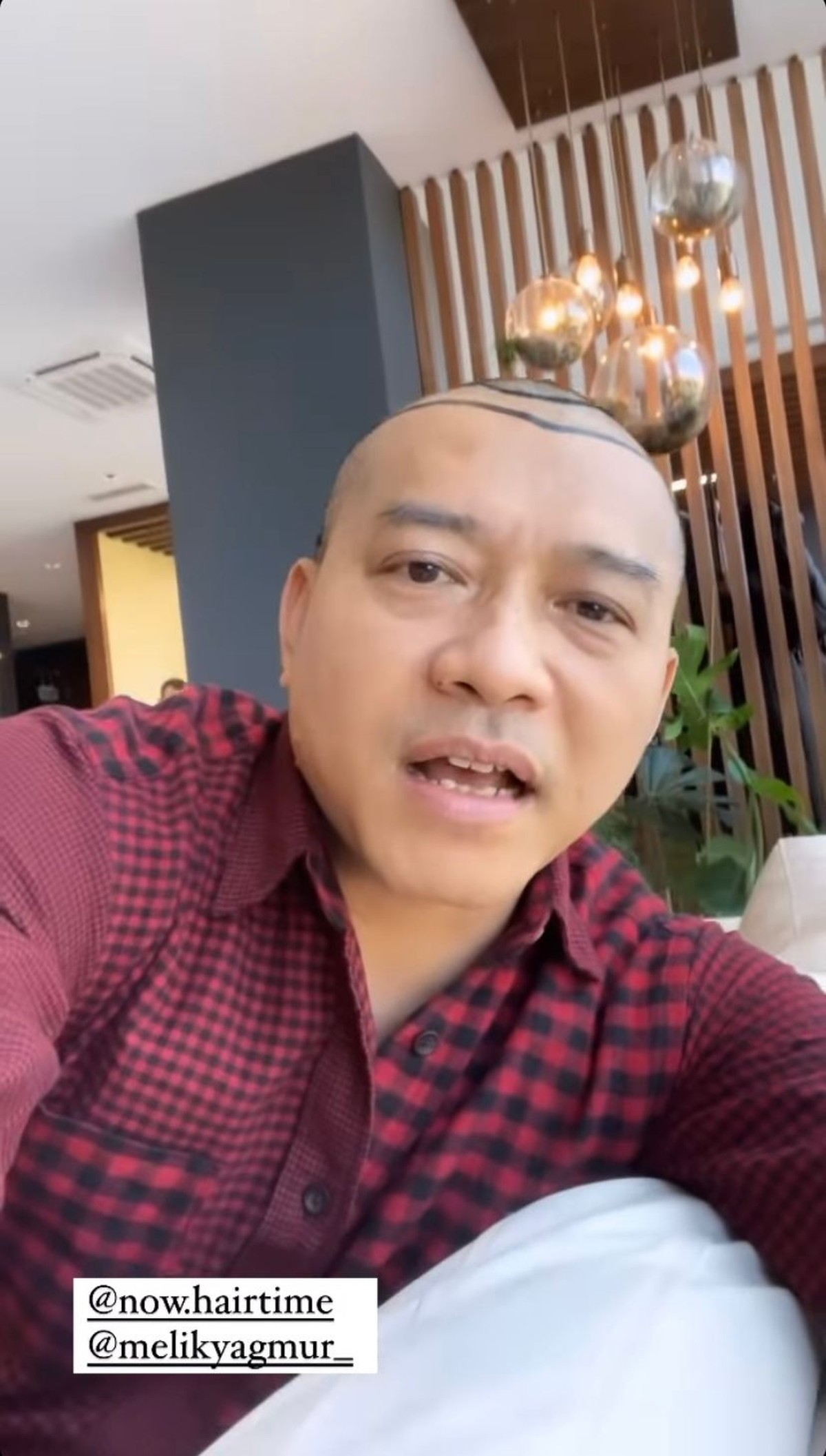 Anang Hermansyah memamerkan rambut barunya yang sangat beda saat liburan di Turkey&period; Yuk intip potretnya&excl;