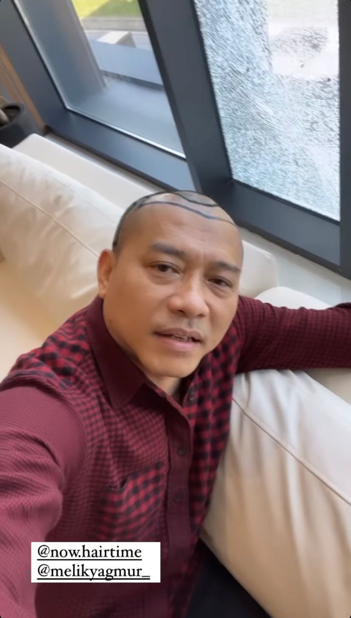 Anang Hermansyah memamerkan rambut barunya yang sangat beda saat liburan di Turkey&period; Yuk intip potretnya&excl;