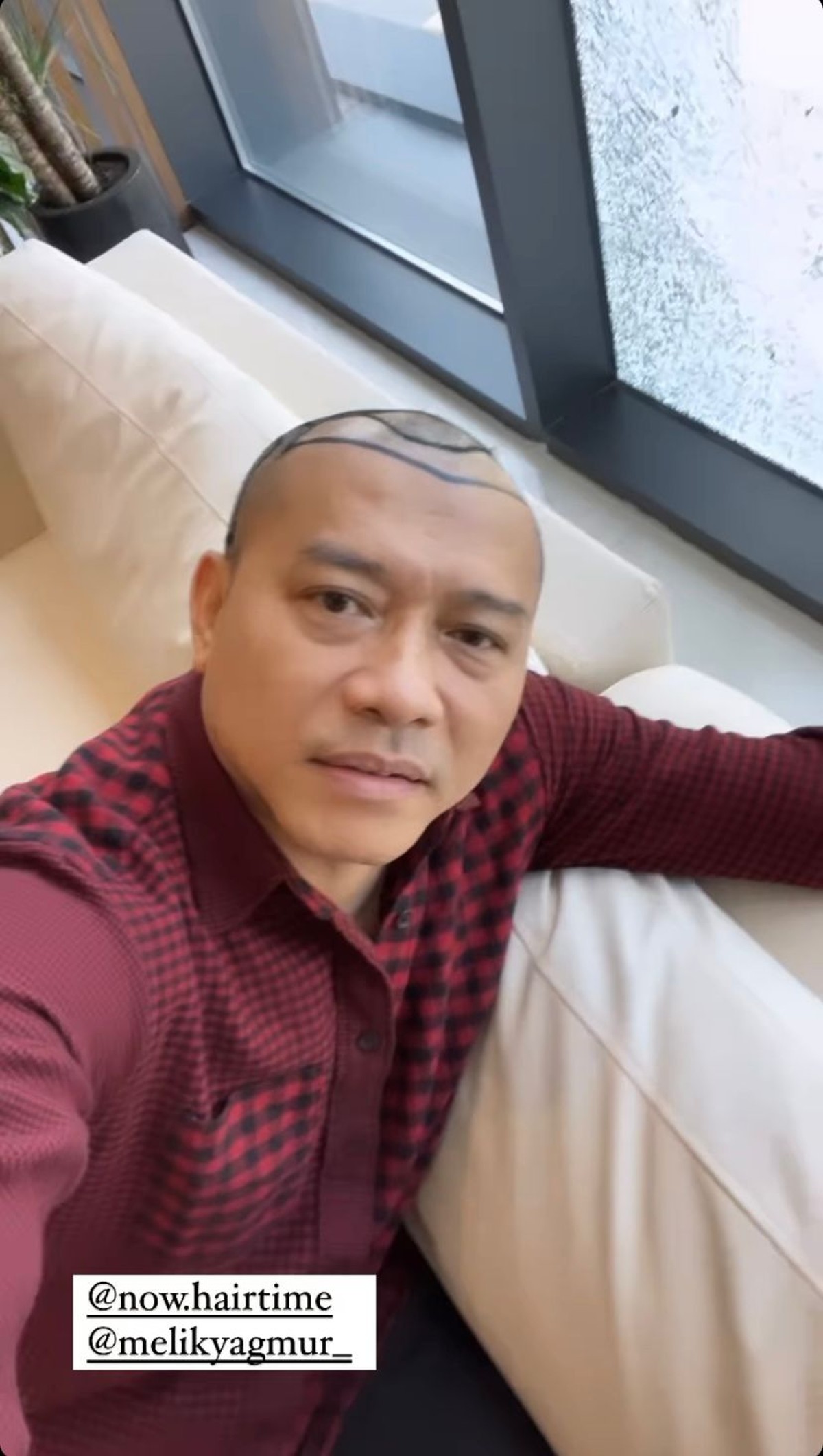 Anang Hermansyah memamerkan rambut barunya yang sangat beda saat liburan di Turkey&period; Yuk intip potretnya&excl;