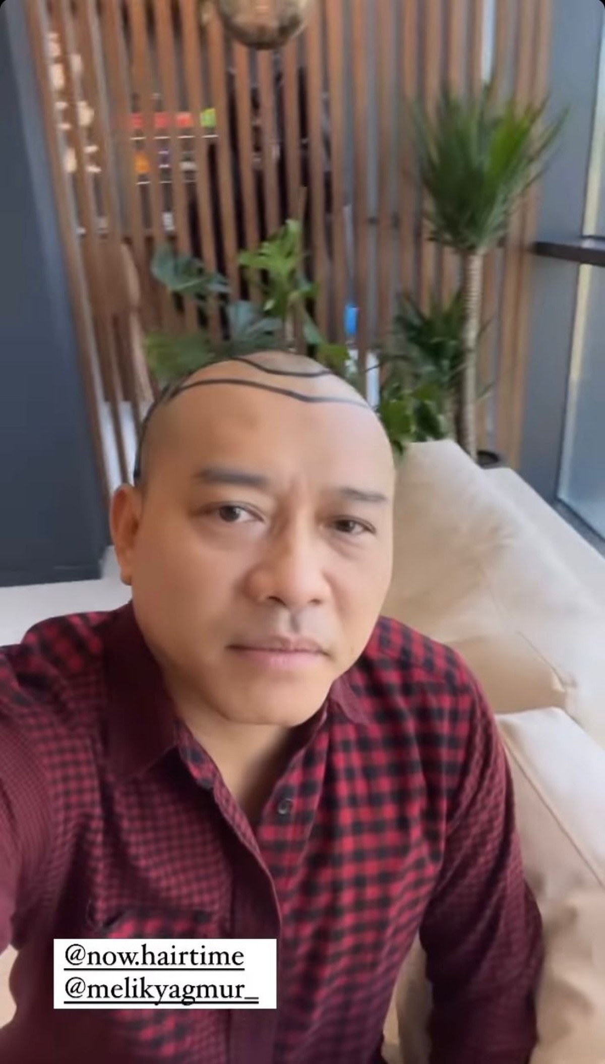 Anang Hermansyah memamerkan rambut barunya yang sangat beda saat liburan di Turkey&period; Yuk intip potretnya&excl;