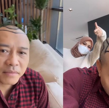 7 Penampilan Terbaru & Beda Anang Hermansyah dengan Rambut Botak