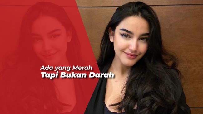 Heboh Tanda Merah di Dada Cassadra Angelie, Netizen: Itu Cupang
