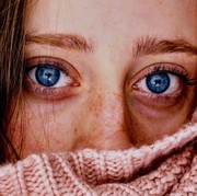 Digaruk Tinggalkan Bekas, Tak Digaruk Sangat Gatal, Ini 3 Perawatan Eksim pada Wajah Biar Nggak Serba Salah