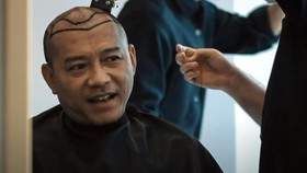 Anang Hermansyah Bagikan Kisah Transplantasi Rambut di Turki