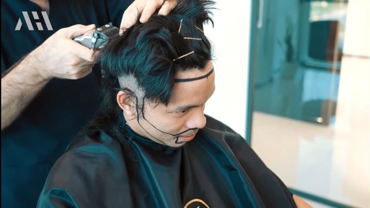 Susul Anang Hermansyah&comma; Atta Halilintar juga mengubah penampilannya dengan transplantasi rambut&period; Yuk intip&excl;