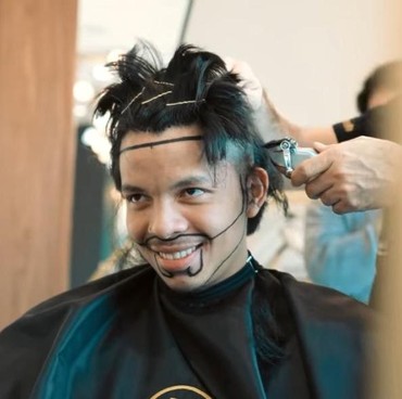 Hampir Botak, 7 Potret Atta Halilintar Transplantasi Rambut di Turki