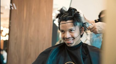 Jalani Transplantasi Rambut, Atta Halilintar Tak PD Punya Jidat Lebar