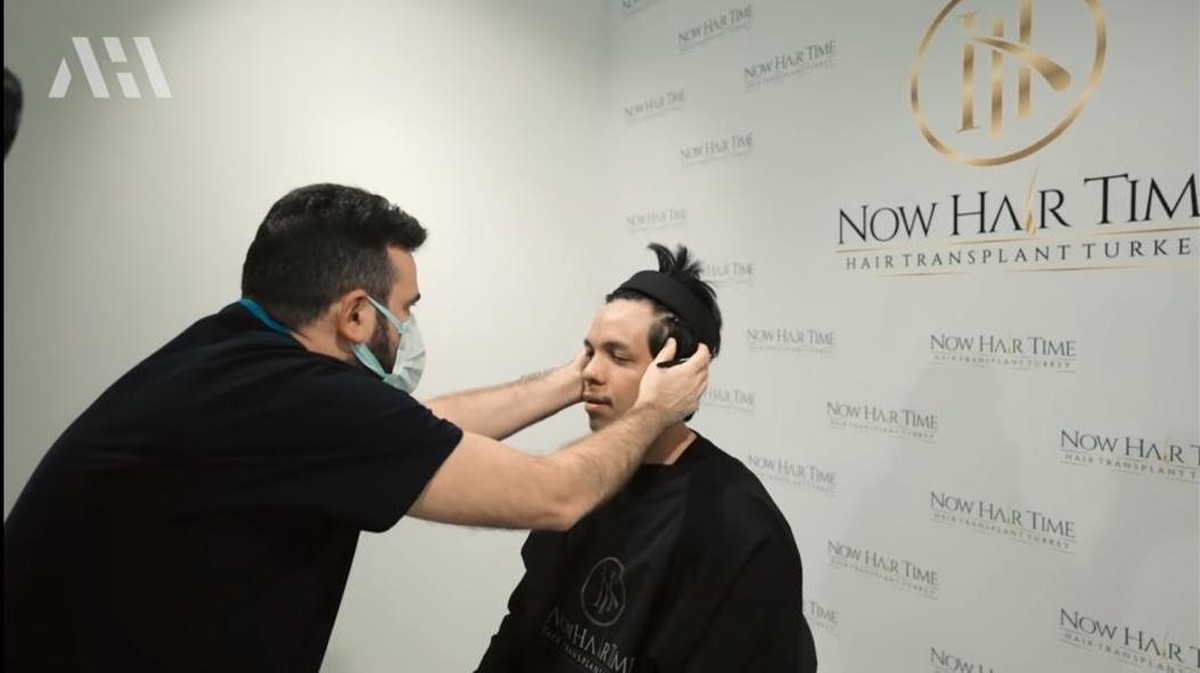 Susul Anang Hermansyah&comma; Atta Halilintar juga mengubah penampilannya dengan transplantasi rambut&period; Yuk intip&excl;