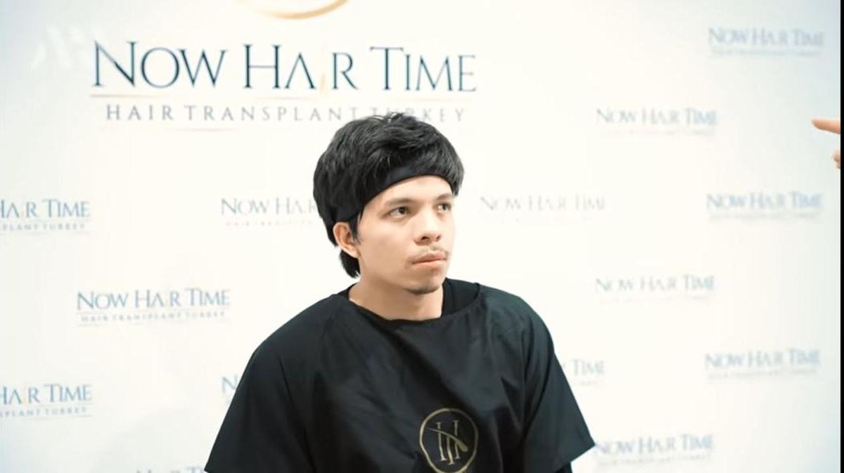 Susul Anang Hermansyah&comma; Atta Halilintar juga mengubah penampilannya dengan transplantasi rambut&period; Yuk intip&excl;
