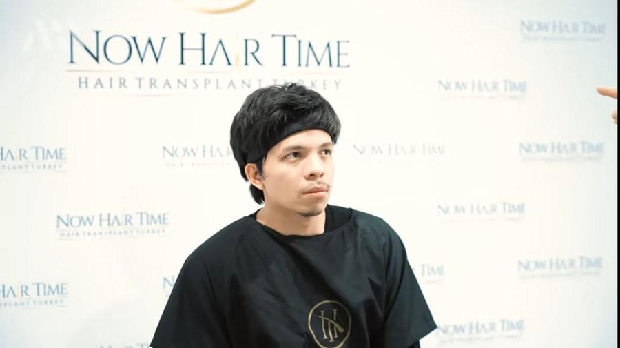 Susul Anang Hermansyah, Atta Halilintar juga mengubah penampilannya dengan transplantasi rambut. Yuk intip!