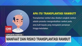 VIDEO: Manfaat dan Risiko Transplantasi Rambut