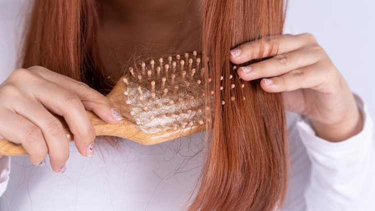 rambut rontok Hair fall problem, closeup hand holding comb and problem hair. Healthcare medical or daily life concept.