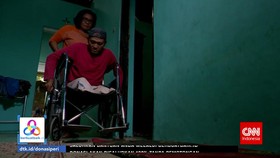 VIDEO: Bantu Peri Membeli Kaki Palsu Lewat berbuatbaik.id
