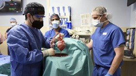FOTO: Proses di Balik Transplantasi Jantung Babi ke Manusia