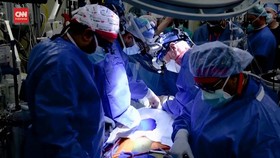 VIDEO: Melihat Proses Transplantasi Jantung Babi ke Manusia