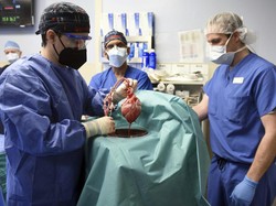Dr Muhammad Mohiuddin: Cangkok Jantung Babi Solusi Krisis Organ