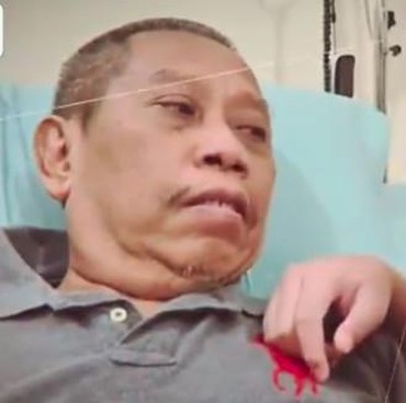 Kondisi Terkini Tukul Arwana, Sudah Membaik hingga Bisa Makan Sendiri