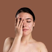 Haruskah Tipe Kulit Kering Tetap Melakukan Eksfoliasi Wajah secara Rutin? Temukan Jawabannya di Sini...