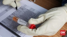 FKM UI: Puncak Lonjakan Covid Arcturus Pertengahan Mei Ini