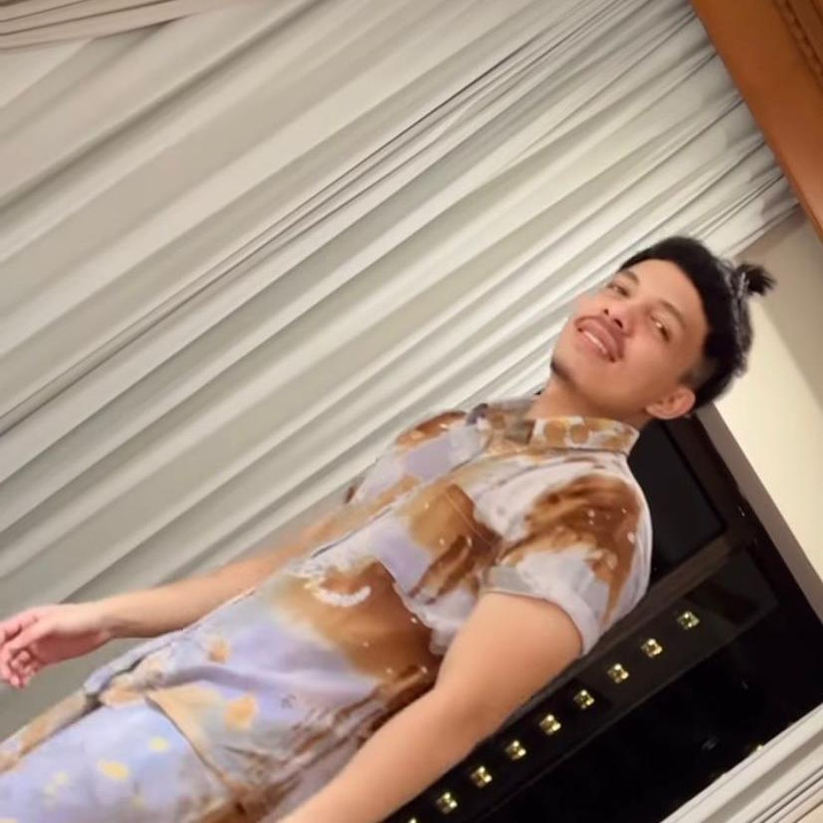 Atta Halilintar baru saja menjalani transplantasi rambut saat liburan di Turkey&comma; ia pun kini tampil pede tanpa bandana&period; Yuk intip&excl;