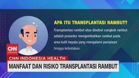 VIDEO: Manfaat dan Risiko Transplantasi Rambut