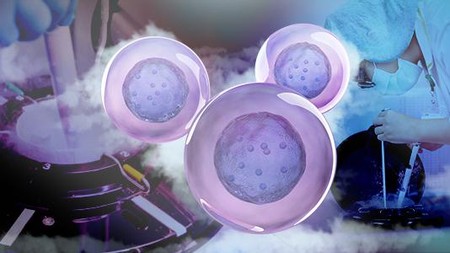 Serba-serbi Egg Freezing