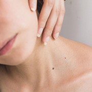 BeauPicks: Racun Baru! Ini 3 Rekomendasi Produk dengan Kandungan Azelaic Acid untuk Basmi Jerawat