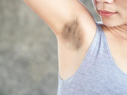 5 Bahan Alami Ini Bisa Cerahkan Ketiak yang Hitam