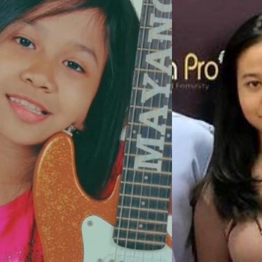 8 Potret Transformasi Mayang Usai Perawatan Wajah Rp80 Juta