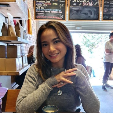 Terkuak, Acha Septriasa Hanya Miliki Satu Ginjal Sejak Kecil