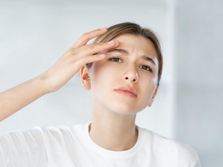 Jerawat Datang Tiba-Tiba? 2 Krim Spot Treatment Ini Bisa Dipakai Langsung di Titiknya