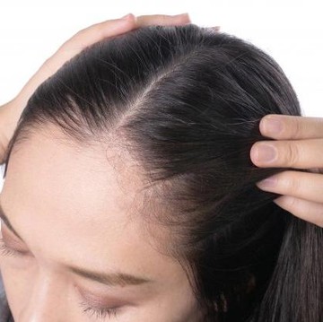 6 Bahan pada Haircare yang Harus Dihindari Jika Rambut Kamu Berketombe