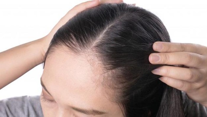 6 Bahan pada Haircare yang Harus Dihindari Jika Rambut Kamu Berketombe