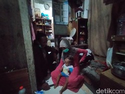 Tolong! Seorang Balita di Surabaya Alami Kelainan Kelamin