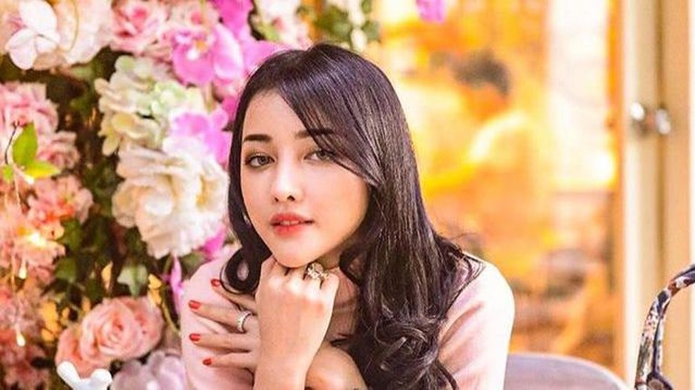 Siwi Sidi Purwanto Siwi Widi Purwanto memiliki paras yang beda banget usai lakukan operasi plastik. Yuk, intip potret transformasinya!
